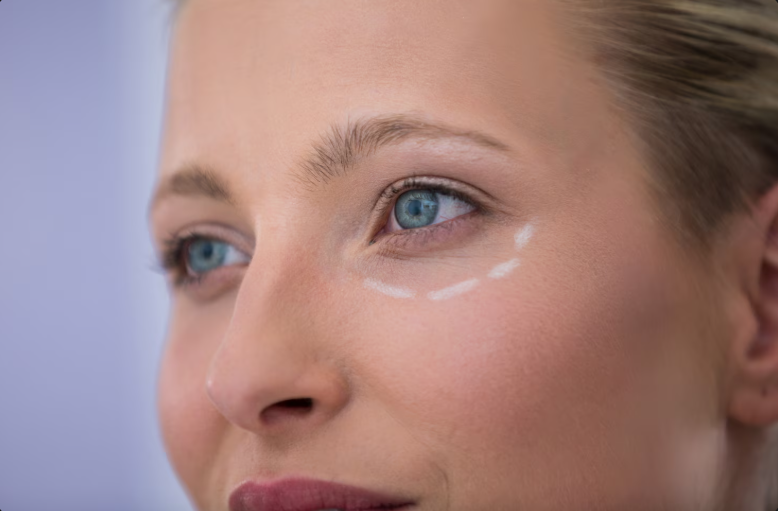 نقش سن در انتخاب کرم دور چشم